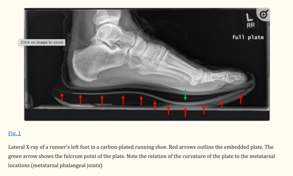 The carbon fiber plate in super shoes has a curvature that doesn't necessarily match the curvature of the foot.